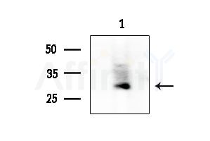 Rim4 Antibody - Western blot analysis of extracts from EC304 cells, using Rim4 Antibody at 1/1000 dilution.