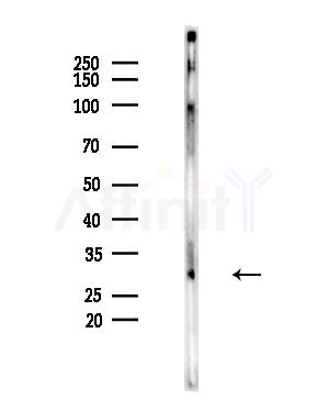 Rim4 Antibody - Western blot analysis of lysates from EC304 cells, using Rim4 Antibody at 1/1000 dilution.