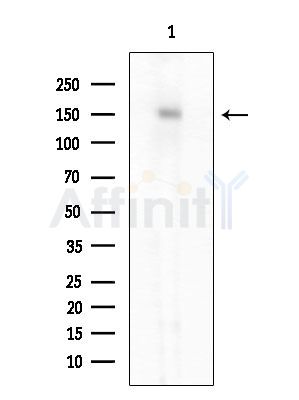 RREB1 Antibody - Western blot analysis of extracts from HepG2 cells, using RREB1 Antibody at 1/1000 dilution.