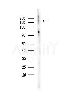 RREB1 Antibody - Western blot analysis of lysates from HepG2 cells, using RREB1 Antibody at 1/1000 dilution.
