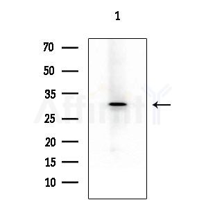 Rsu-1 Antibody - Western blot analysis of extracts from PC12 cells
(LPS 4h treatment), using Rsu-1 Antibody at 1/1000 dilution.