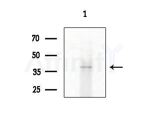 Rsu-1 Antibody - Western blot analysis of extracts from HepG2 cells
(heat-shock treatment), using Rsu-1 Antibody at 1/1000 dilution.