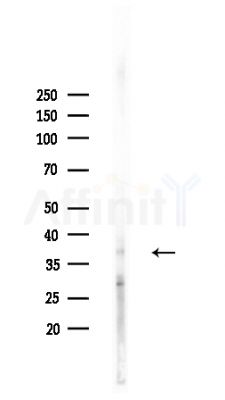 Rsu-1 Antibody - Western blot analysis of lysates from HepG2 cells(heat-shock,45min treatment), using Rsu-1 Antibody at 1/1000 dilution.