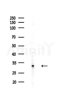 Rsu-1 Antibody - Western blot analysis of lysates from PC12 cells(LPS,4h treatment), using Rsu-1 Antibody at 1/1000 dilution.
