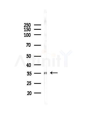 RTCD1 Antibody - Western blot analysis of lysates from HepG2 cells(starvation,24h treatment), using RTCD1 Antibody at 1/1000 dilution.