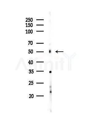 RXR gamma Antibody - Western blot analysis of lysates from Hela cells(starvation,24h treatment), using RXR gamma Antibody at 1/1000 dilution.