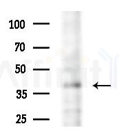 Septin 1 Antibody - Western blot analysis of extracts from EC304 cells(heat-shock treatment), using Septin 1 Antibody at 1/1000 dilution.