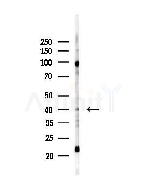 Septin 1 Antibody - Western blot analysis of lysates from EC304 cells(heat-shock,45min treatment), using Septin 1 Antibody at 1/1000 dilution.