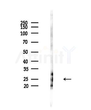 SH3BGR Antibody - Western blot analysis of lysates from PC12 cells(starvation,24h treatment), using SH3BGR Antibody at 1/1000 dilution.