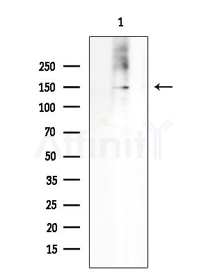 Sin3B Antibody - Western blot analysis of extracts from COLO205 cells, using Sin3B Antibody at 1/1000 dilution.