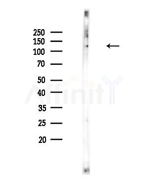 Sin3B Antibody - Western blot analysis of lysates from COLO205 cells, using Sin3B Antibody at 1/1000 dilution.