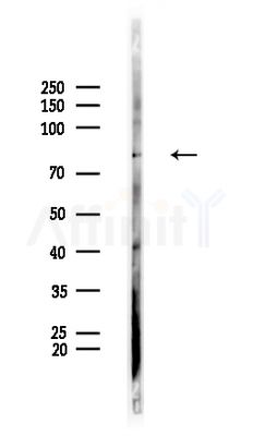SPHK2 Antibody - Western blot analysis of lysates from Rat brain, using SPHK2 Antibody at 1/1000 dilution.