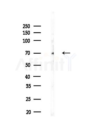STAM2 Antibody - Western blot analysis of lysates from B16F10-LUC cells(LPS,4h treatment), using STAM2 Antibody at 1/1000 dilution.