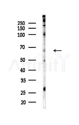 TAUT Antibody - Western blot analysis of lysates from HUVEC cells(starvation,24h treatment), using TAUT Antibody at 1/1000 dilution.
