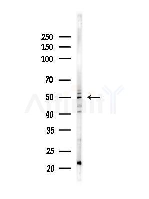 TBL2 Antibody - Western blot analysis of lysates from Hela cells(heat-shock,45min treatment), using TBL2 Antibody at 1/1000 dilution.