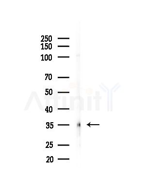 TIS11B Antibody - Western blot analysis of lysates from HepG2 cells(LPS,4h treatment), using TIS11B Antibody at 1/1000 dilution.