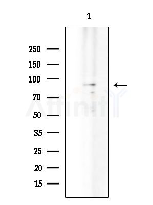 TLE4 Antibody - Western blot analysis of extracts from EC304 cells, using TLE4 Antibody at 1/1000 dilution.