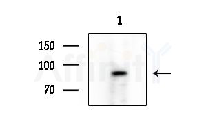 TLE4 Antibody - Western blot analysis of extracts from Rat testis, using TLE4 Antibody at 1/1000 dilution.