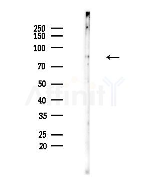 TLE4 Antibody - Western blot analysis of lysates from EC304 cells, using TLE4 Antibody at 1/1000 dilution.