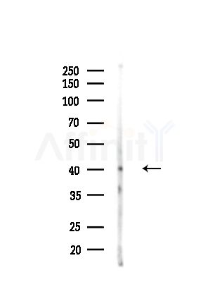 TOB1 Antibody - Western blot analysis of lysates from Hela cells(heat-shock,45min treatment), using TOB1 Antibody at 1/1000 dilution.
