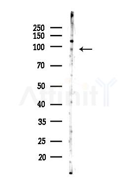 TUTase Antibody - Western blot analysis of lysates from EC304 cells, using TUTase Antibody at 1/1000 dilution.