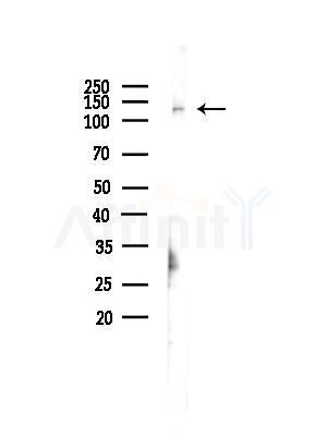 USP36 Antibody - Western blot analysis of lysates from Mouse testis, using USP36 Antibody at 1/1000 dilution.