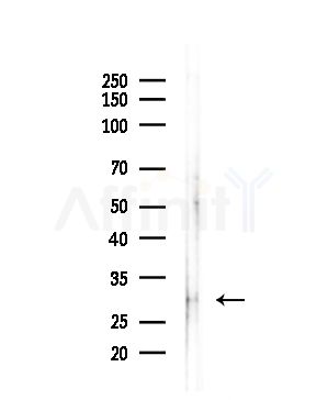 V1RL3 Antibody - Western blot analysis of lysates from Hela cells(LPS,4h treatment), using V1RL3 Antibody at 1/1000 dilution.
