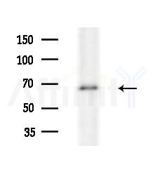 WAVE4 Antibody - Western blot analysis of extracts from A549 cells(heat-shock treatment), using WAVE4 Antibody at 1/1000 dilution.