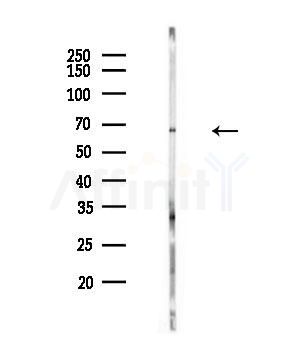 WAVE4 Antibody - Western blot analysis of lysates from A549 cells(heat-shock,45min treatment), using WAVE4 Antibody at 1/1000 dilution.