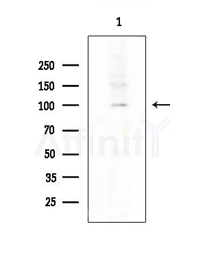 WDHD1 Antibody - Western blot analysis of extracts from EC304 cells, using WDHD1 Antibody at 1/1000 dilution.