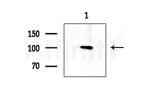 WDHD1 Antibody - Western blot analysis of extracts from COLO205 cells, using WDHD1 Antibody at 1/1000 dilution.
