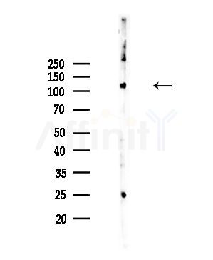 WDHD1 Antibody - Western blot analysis of lysates from COLO205 cells, using WDHD1 Antibody at 1/1000 dilution.