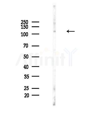 WDHD1 Antibody - Western blot analysis of lysates from EC304 cells, using WDHD1 Antibody at 1/1000 dilution.