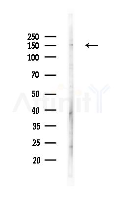 YEATS2 Antibody - Western blot analysis of lysates from Hela cells(heat-shock,45min treatment), using YEATS2 Antibody at 1/1000 dilution.