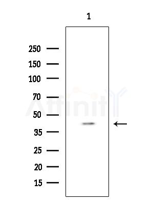 ZIP2 Antibody - Western blot analysis of extracts from COLO205 cells, using ZIP2 Antibody at 1/1000 dilution.
