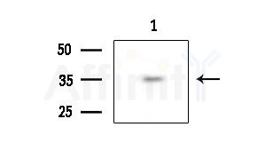 ZIP2 Antibody - Western blot analysis of extracts from EC304 cells, using ZIP2 Antibody at 1/1000 dilution.