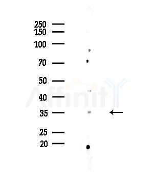 ZIP2 Antibody - Western blot analysis of lysates from EC304 cells, using ZIP2 Antibody at 1/1000 dilution.