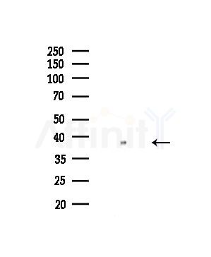 ZIP2 Antibody - Western blot analysis of lysates from COLO205 cells, using ZIP2 Antibody at 1/1000 dilution.