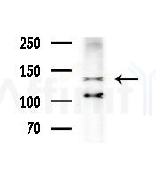 ZNF262 Antibody - Western blot analysis of extracts from HepG2 cells(LPS,4h treatment), using ZNF262 Antibody at 1/1000 dilution.