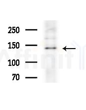 ZNF262 Antibody - Western blot analysis of extracts from COLO205 cells(heat-shock,45min treatment), using ZNF262 Antibody at 1/1000 dilution.