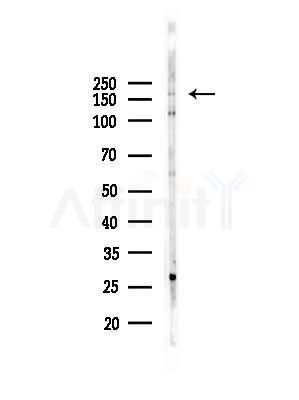 ZNF262 Antibody - Western blot analysis of lysates from COLO205 cells(heat-shock,45min treatment), using ZNF262 Antibody at 1/1000 dilution.