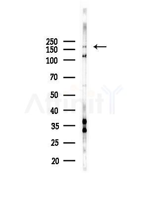 ZNF262 Antibody - Western blot analysis of lysates from HepG2 cells(LPS, 4h treatment), using ZNF262 Antibody at 1/1000 dilution.