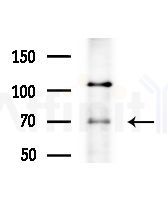 CSGALNACT1 Antibody - Western blot analysis of extracts from HepG2 cells(LPS,4h treatment), using CSGALNACT1 Antibody at 1/1000 dilution.