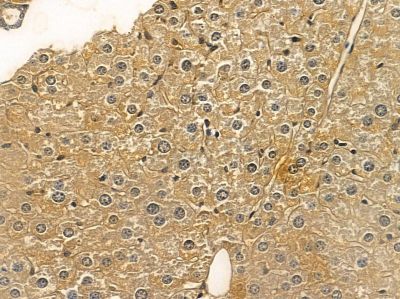NHE-3 Mouse Monoclonal Antibody - BF8551 at 1/100 staining mouse liver tissue by IHC-P.