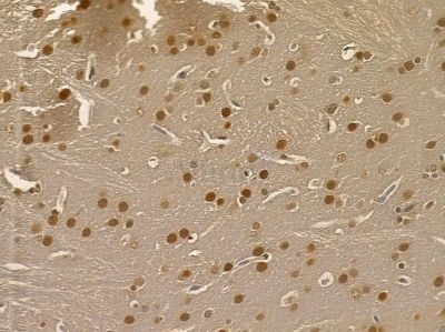 Nucleophosmin Mouse Monoclonal Antibody - BF8554 at 1/100 staining rat kidney tissue by IHC-P.