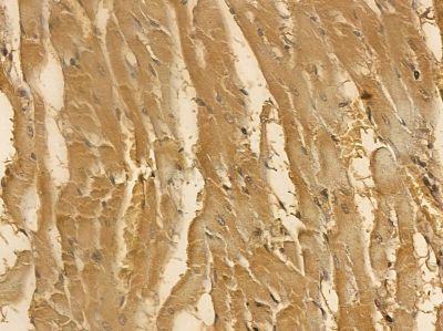 EEF2 Mouse Monoclonal Antibody - BF8556 at 1/100 staining rat heart tissue by IHC-P.