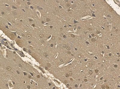 TDP43 Mouse Monoclonal Antibody - BF8566 at 1/100 staining rat brain tissue by IHC-P.