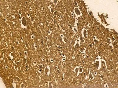 TDP43 Mouse Monoclonal Antibody - BF8566 at 1/100 staining mouse brain tissue by IHC-P.