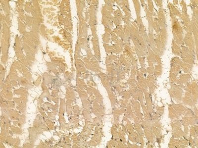SEPN1 Mouse Monoclonal Antibody - BF8578 at 1/100 staining rat heart tissue by IHC-P.