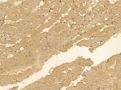 SMAP2 Mouse Monoclonal Antibody - BF8585 at 1/100 staining rat heart tissue by IHC-P.